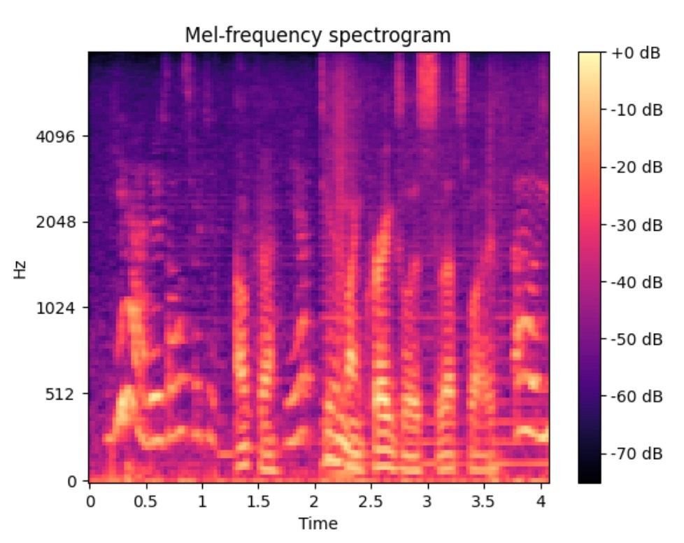 Depression Detection using Speech